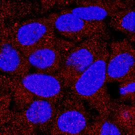 DPP3 antibody in HeLa Human Cell Line by Immunocytochemistry (ICC).