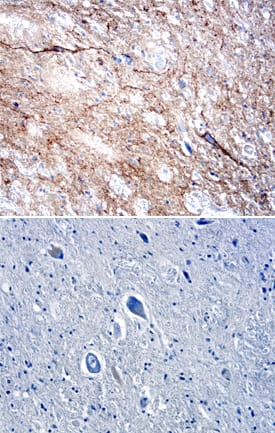 DPP6 antibody in Human Spinal Cord by Immunohistochemistry (IHC-P).