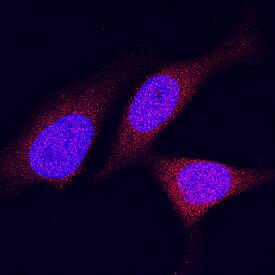 DPP9 antibody in HeLa Human Cell Line by Immunocytochemistry (ICC).