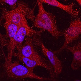 DPP9 antibody in HeLa Human Cell Line by Immunocytochemistry (ICC).