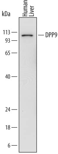 Detection of Human DPP9 antibody by Western Blot.