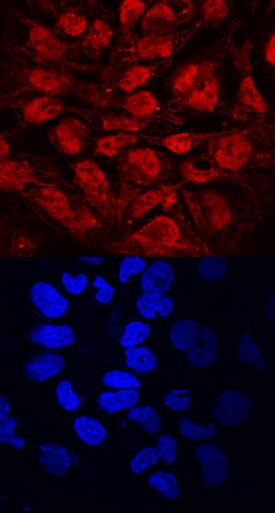 DPPA2 antibody in BG01V Human Embryonic Stem Cells by Immunocytochemistry (ICC).