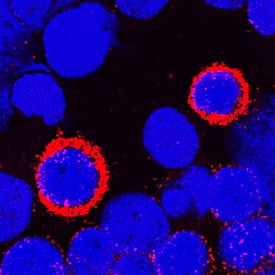 DPPIV/CD26 antibody in Human PBMCs by Immunocytochemistry (ICC).