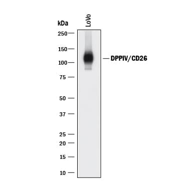 Detection of Human DPPIV/CD26 antibody by Western Blot.
