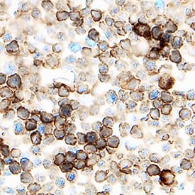 DPPIV/CD26 antibody in Mouse Thymus by Immunohistochemistry (IHC-Fr).