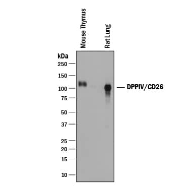 Detection of Mouse and Rat DPPIV/CD26 antibody by Western Blot.