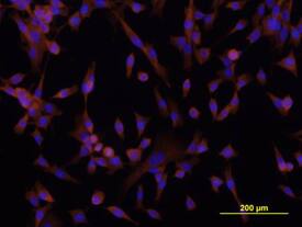 DSCAM antibody in A172 Human Cell Line by Immunocytochemistry (ICC).