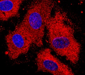 DSPG3 antibody in Human HUVEC by Immunocytochemistry (ICC).