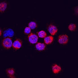 DTX1/DTX4 antibody in K562 Human Cell Line by Immunocytochemistry (ICC).