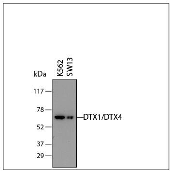 Detection of Human DTX1/DTX4 antibody by Western Blot.