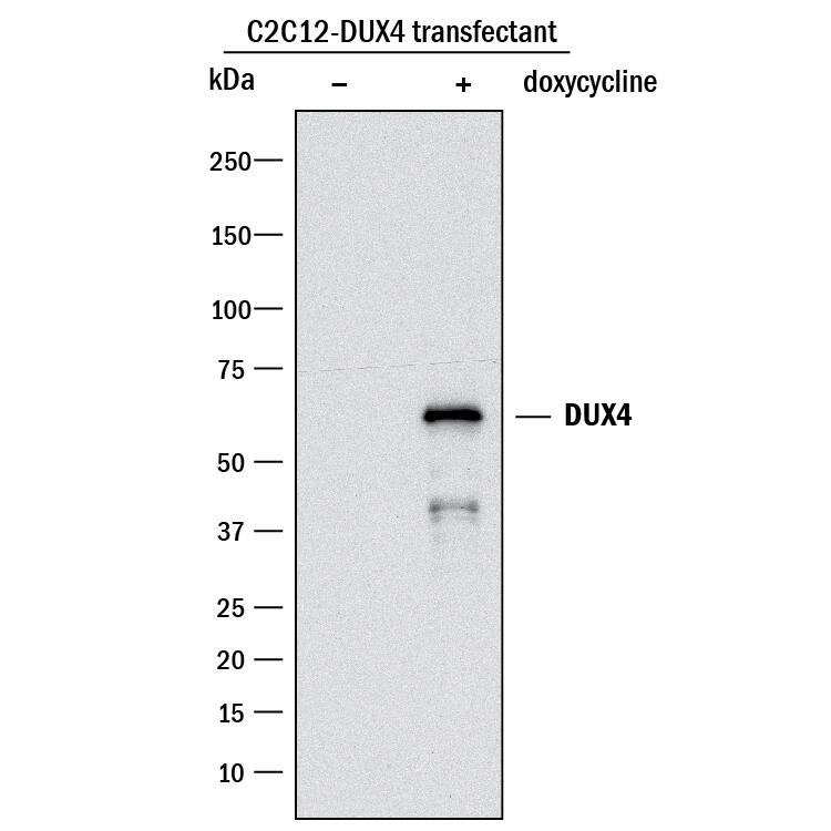 Detection of Human DUX4/DUX4c antibody by Western Blot.