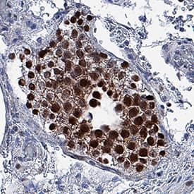 DUX4 antibody in Human Testis by Immunohistochemistry (IHC-P).