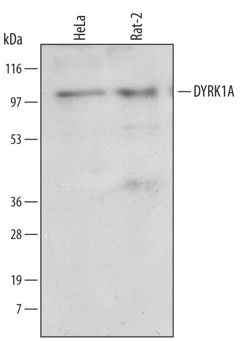 Detection of Human/Rat DYRK1A antibody by Western Blot.