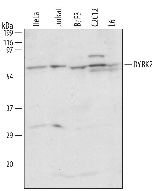 Detection of Human/Mouse/Rat DYRK2 antibody by Western Blot.