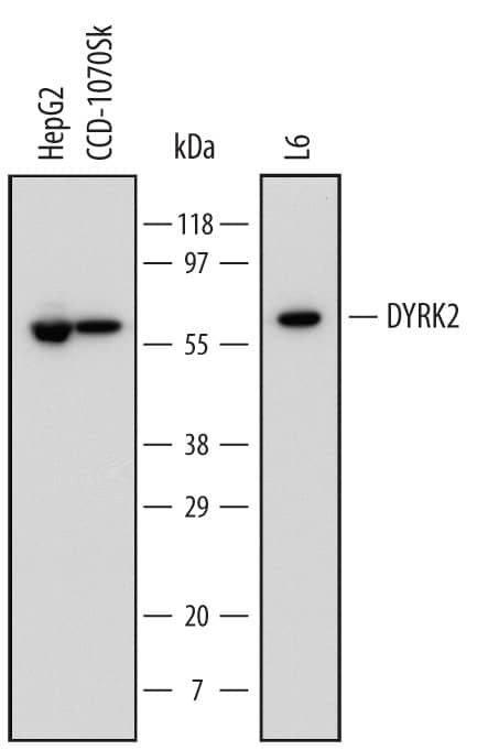 Detection of Human and Rat DYRK2 antibody by Western Blot.