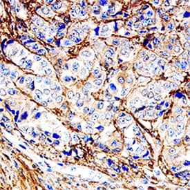 Decorin antibody in Human Breast by Immunohistochemistry (IHC-P).