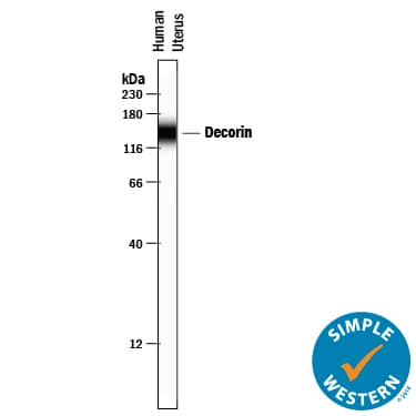 Detection of Human Decorin antibody by Simple WesternTM.