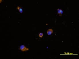 Dectin-1/CLEC7A antibody in Human Dendritic Cells by Immunocytochemistry (ICC).