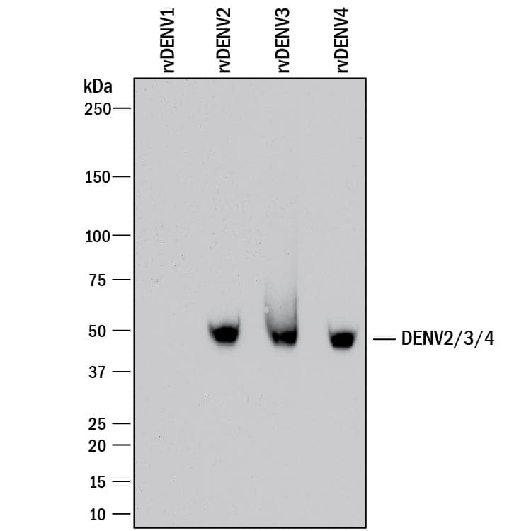 Detection of Dengue Virus NS1 antibody by Western Blot.