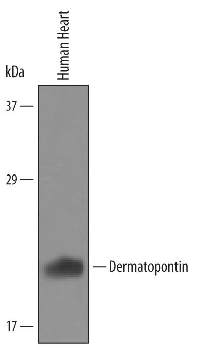 Detection of Human Dermatopontin antibody by Western Blot.