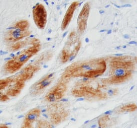 Desmin antibody in Human Heart by Immunohistochemistry (IHC-P).