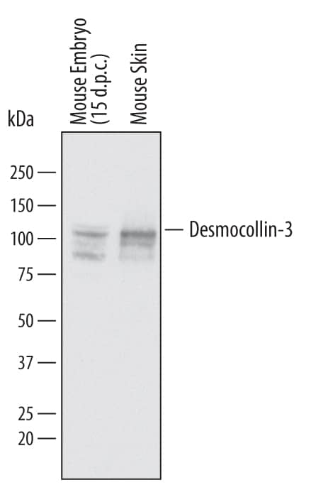 Detection of Mouse Desmocollin-3 antibody by Western Blot.