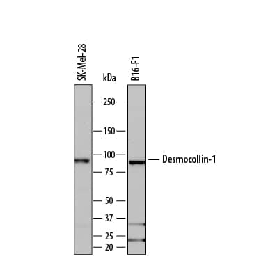 Detection of Human and Mouse Desmocollin-1 antibody by Western Blot.