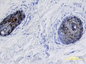 Desmoglein-1 antibody in Human Skin by Immunohistochemistry (IHC-P).