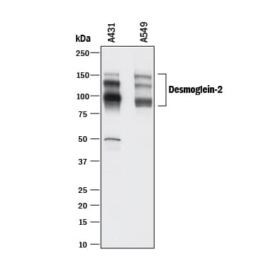 Detection of Human Desmoglein-2 antibody by Western Blot.