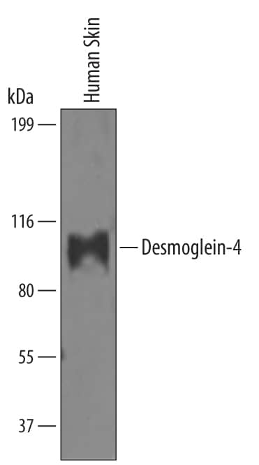 Detection of Human Desmoglein-4 antibody by Western Blot.