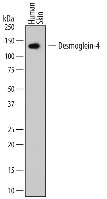 Detection of Human Desmoglein-4 antibody by Western Blot.