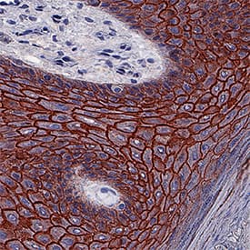 Desmoglein-1 antibody in Human Skin Hyperplasia by Immunohistochemistry (IHC-P).