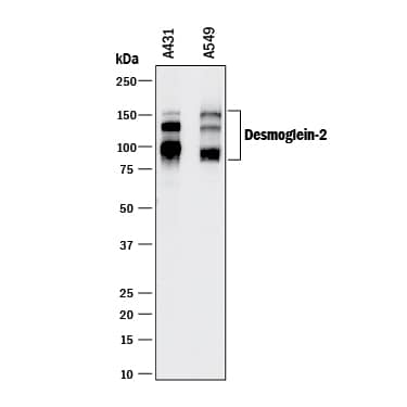 Detection of Human Desmoglein-2 antibody by Western Blot.