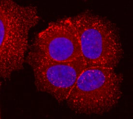 Desmoglein-2 antibody in MCF-7 Human Cell Line by Immunocytochemistry (ICC).