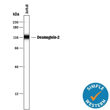 Detection of Human Desmoglein-2 antibody by Simple WesternTM.