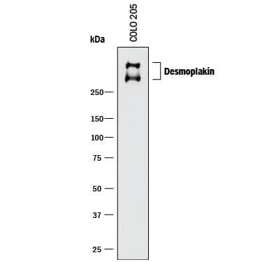 Detection of Human Desmoplakin antibody by Western Blot.