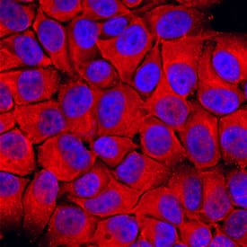 Dihydrofolate Reductase/DHFR antibody in MCF-7 Human Cell Line by Immunocytochemistry (ICC).