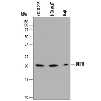 Detection of Human Dihydrofolate Reductase/DHFR antibody by Western Blot.