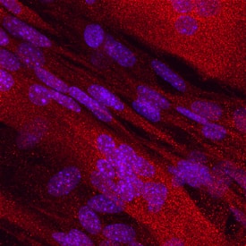 Dihydrofolate Reductase/DHFR antibody in C2C12 Mouse Cell Line by Immunocytochemistry (ICC).