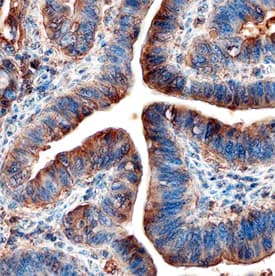 Dkk-1 antibody in Human Colon by Immunohistochemistry (IHC-P).