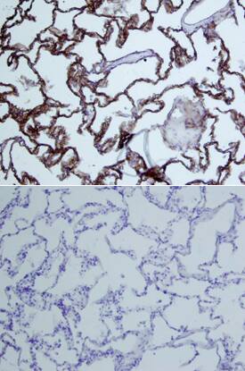 Dkk-3 antibody in Human Lung by Immunohistochemistry (IHC-P).