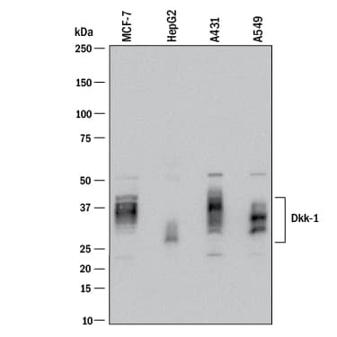 Detection of Human Dkk-1 antibody by Western Blot.