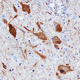 Dopa Decarboxylase/DDC antibody in Human Brain by Immunohistochemistry (IHC-P).