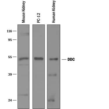 Detection of Human, Mouse, and Rat Dopa Decarboxylase/DDC antibody by Western Blot.