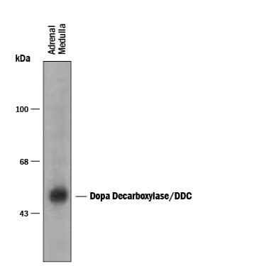 Detection of Dopa Decarboxylase/DDC antibody by Western Blot.