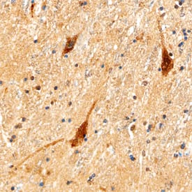Dopamine D1 R/DRD1 antibody in Human Brain by Immunohistochemistry (IHC-P).