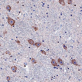 Dopamine D2 R/DRD2 antibody in Human Brain by Immunohistochemistry (IHC-P).