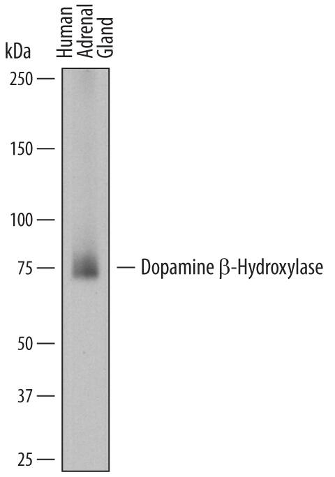 Detection of Human Dopamine  beta-Hydroxylase antibody by Western Blot.