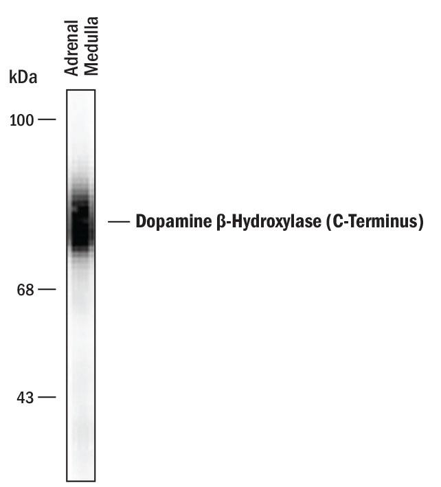 Detection of Dopamine  beta-Hydroxylase (C-Terminus) antibody by Western Blot.