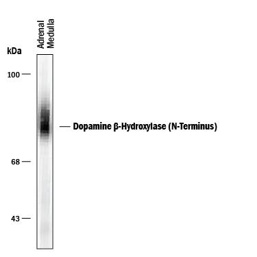 Detection of Dopamine  beta‑Hydroxylase (N-Terminus).